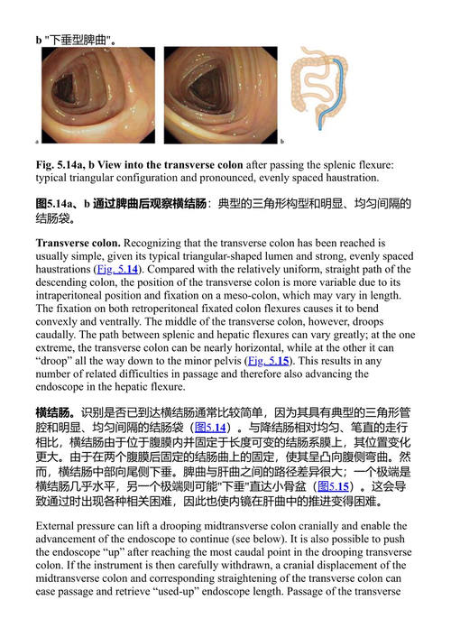 结肠镜检查图谱 赫尔穆特·梅斯曼 (中英对照电子书)