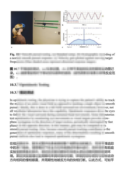 临床耳科学(第4版) 迈尔斯·L·彭萨克、丹尼尔·I·朱 (中英对照电子书)