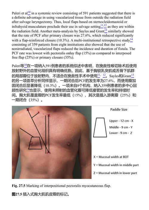喉癌：基于临床病例的处理方法 罗热里奥·A·德迪维斯, 乔治·佩雷蒂, 伊哈布·汉纳, 克劳迪奥·R·塞尔内亚 (中英对照电子书)