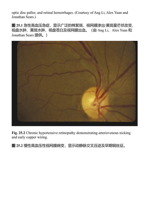 视网膜图解 贾斯提斯·P·埃勒斯 (中英对照电子书)