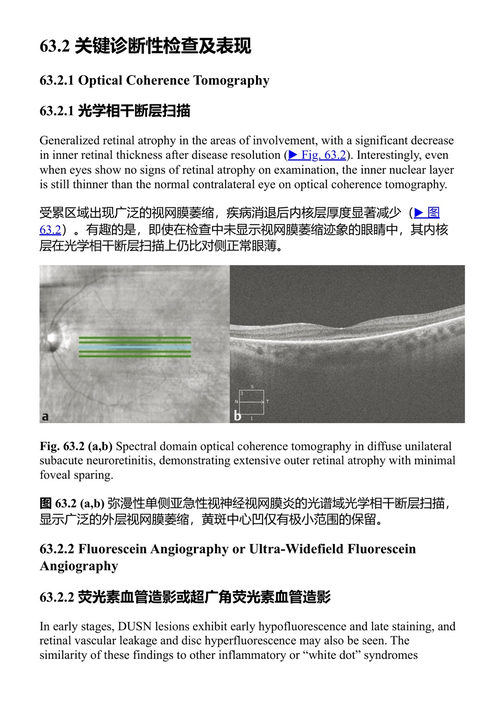 视网膜图解 贾斯提斯·P·埃勒斯 (中英对照电子书)