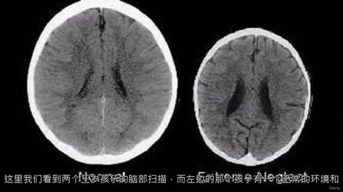 家长神经科学指南:养育优秀孩子的实用课程 (中文字幕英文视