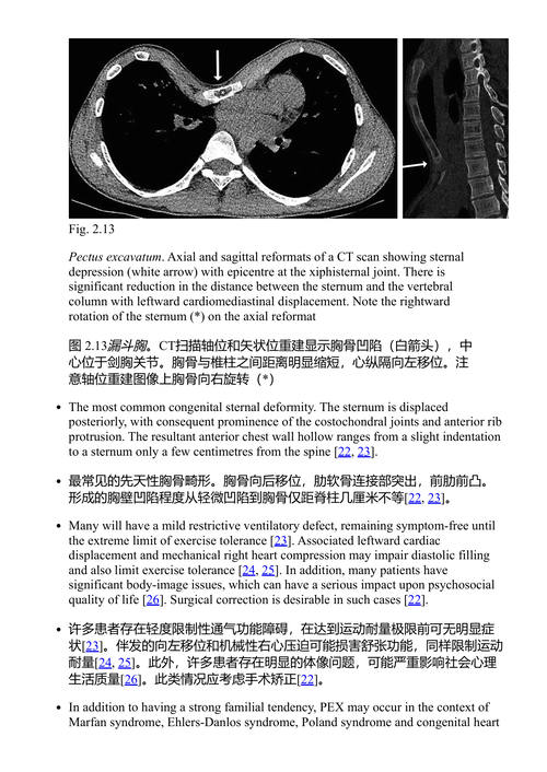 影像解剖变异:临床实践中的应用 (中英对照电子书)