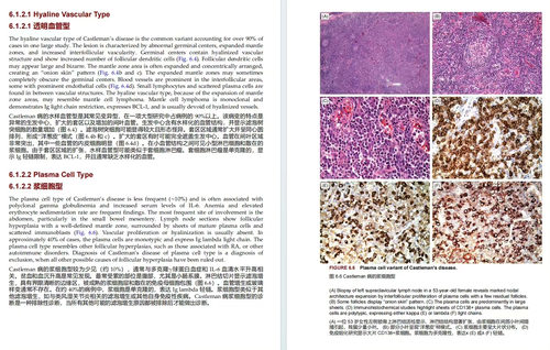 奈姆血液病理学图谱:形态学、免疫表型、细胞遗传学及分子生物学