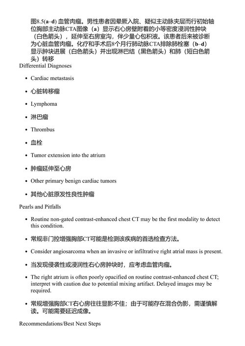 胸部CT检查中的偶发性心血管发现 勒内·E·坎扎 (中英对照电子书)